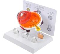 Human Eye Anatomy Model with 5 Interchangeable Cataract Corneas, PVC Eye Model for Science Education Student Learning Medical Teaching Patient Demonstration 1PCS