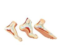 Human Foot Model - 3 Piece Anatomy Model for Podiatry and Education | Human Foot Model - Anatomical 3 Piece Model for Podiatry Education and Training, Ideal for Medical Students