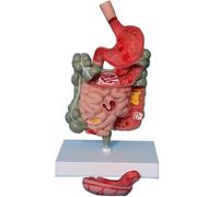 Human Gastrointestinal Anatomy Model, Removable Digestive System Pathology Model with Stomach, Large Intestine, Rectum, Duodenum Model for Science Study Display