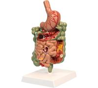 Human Gastrointestinal Model, Digestive System Disease Model, Anatomy Model with Removable Stomach and Stand, Shows Common Pathologies, for Teaching, Studying