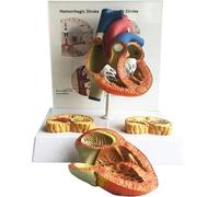 Human Heart Anatomical Model, Human Atrial Fibrillation Simulation Model