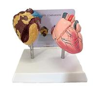 Human Heart Anatomy Model Detachable, 17CM Handmade PVC Organ Model Ideal for Comparative Pathology Study Human Model