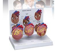 Human Heart Model for Medical Education, Anatomical Pathology Study Aid for Science Learning & Teaching