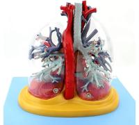 Human Heart Model, Human Lung Tracheobronchial Tree Model, Thoracic Surgery Cardiology Internal Medicine Respiratory System for Medical Teaching