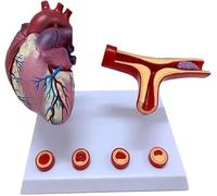 Human Heart Model with Coronary Artery Bypass - Educational Anatomy Model for Cardiology Studies