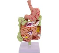Human Intestine Pathological Anatal Model - Gastrointestinal Tract (Cecum, Rectum, Duodenum) Study Aid