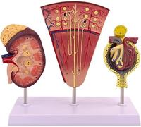 Human Kidney Anatomy Model, 3-Part Enlarge Nephron Glomerulus Renal Structure Anatomy Model, For Demonstrate The Kidney Structure And Function.