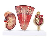 Human Kidney Anatomy Model,3-Part Kidney Model With Kidney Cross Section,Nephron And Glomerulus,Anatomically Accurate Medical Teaching Tool For Medical Students,Doctors