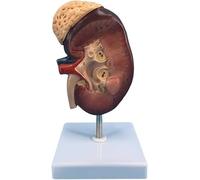 Human Kidney Model - 2X Magnification Anatomical Teaching Aid with Accurate Structure & Digital Labels