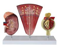 Human Kidney Model, 3-Part Renal Structure Model, Human Kidney Nephron and Glomerulus Model, for Anatomy Students, Urologists, Patient Consultation