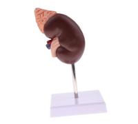 Human Kidney Model with 24 Anatomical Markers for Doctors Office and Educational Purposes, Clear Zoning, PVC Material