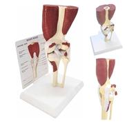 Human Knee Joint Anatomical Model with Ligaments, Knee Flexion Model Knee Joint with Muscles Educational Tool