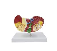 Human Liver Anatomical Model Damage Lesion Detachable Base for Educational Training on Display