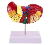 Human Liver Model - Anatomical Pathology Liver Model,Anatomical Model With Base, Clear Texture And Liver Cirrhosis Pathological Features,for School Study And Research