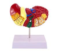 Human Liver Model - Anatomical Pathology Liver Model, Life Size Anatomy Mode with Base and Clear Texture and Pathological Features Liver Cancer Model for Teaching Display Study Supplies