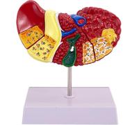 Human Liver Model - Anatomical Pathology Liver Model, with Base and Clear Texture and Pathological Features Liver Cirrhosis Model for School Study and Teaching
