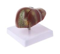 Human Liver Pathological Anatomical Model Anatomy School Medical Teaching Displa Teaching Model Airplane