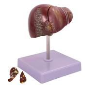 Human Liver Pathological Anatomical Model, Life Size Human Liver Gallbladder Anatomy Model with 2 Detachable Parts, for Teaching Demonstration and Explanation