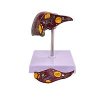 Human Liver Pathological Model Life Size Pathological Liver Anatomy Model with Clear Texture and Pathological Features and 2 Detachable Parts for Teaching Science Classroom Study Models
