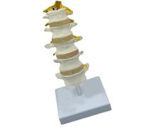 Human Lumbar Spine Model Five Segment Lumbar Spine Anatomy Model Teaching Tool for Classroom Demonstration and Research Human Vertebrae Anatomy
