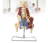 Human Lumbar Spine Model, Human Five Lumbar Vertebrae With Nerve Intervertebral Disc Herniation with Unilateral Psoas Pelvic Muscle for TMedical Education Teaching
