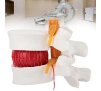 Human Lumbar Vertebrae Model with Herniated Disc, PVC Material for Medical Teaching and Scientific Presentations