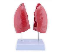 Human Lung Anatomical Model 1:1 Life Size Respiratory System Anatomy Model with 4 Detachable Parts and Accurate Anatomy for Learning and Understanding The Structure of The Lung