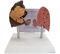 Human Lung Anatomical Model with Pathological Features, Accurate Anatomy Structure for Smoking Health Education, Medical Teaching
