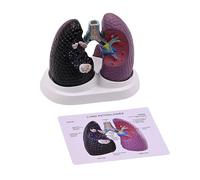Human Lung Anatomy Model Anatomical Pathological Lung Model Realistic Pathological Anatomy Teaching Tool Study