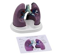 Human Lung Anatomy Model Realistic Pathological for Educational Use and Clinical Demonstration PVC