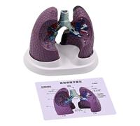 Human Lung Anatomy Model Realistic Pathological for Educational Use and Clinical Demonstration PVC