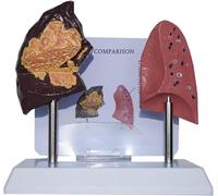 Human Lung Anatomy Model, Smoker's Lung vs Healthy Lung Comparative Model, Lung Function Respiratory System Demonstration Model, for Medical Teaching Exhibition.