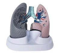 Human Lung Anatomy Model Smoking Lung and Healthy Lung Model Human Respiratory System Organ Model as Teaching Props for Students Study Display Teaching Model