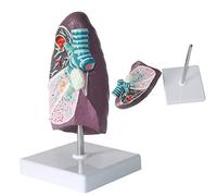 Human Lung Model,Medical Human Pathological Lung Model,Lung Anatomy Respiratory System Model Human Body Anatomy Replica