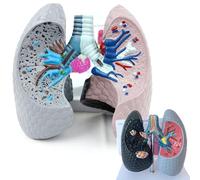 Human Lung Model, Pathological Anatomy and Healthy Lung Representation for Classroom Teaching