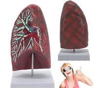 Human Lung Segment Anatomy Model,Bronchovascular Respiratory System Model,Human Organs Normal Lung Model for Teaching,12 * 12 * 25Cm