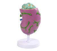 Human Lymph Node Anatomy Model Anatomical Lymphatic Structure Model for Clinical Settings Classroom Demonstration Anatomy
