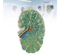Human Lymph Node Model, Enlarged Lymph Node Anatomical Model, Lymphatic System Anatomy Structure Unit, 3D Biology Medical Teaching Demonstration Guide