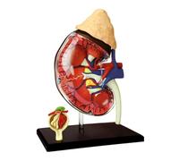 Human Model 4d Vision Human Kidney Anatomy Model Detachable 13 Parts For Science Medical Anatomy