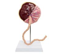 Human Neonatal Placenta Model, Removable Umbilical Cord Placenta Anatomical Model, Life Size Veins Arterial Embryo Tissue Structure, for Obstetrics and Gynecology Teaching Tool.