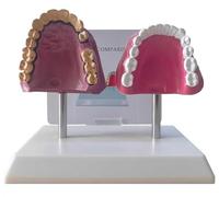 Human Oral Teeth Anatomy Model Smoking & Healthy Teeth Comparative