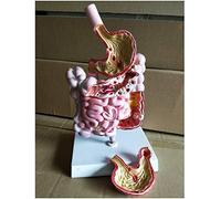 Human Organ Anatomical Model Digestive System Disease Model Pathological Model of Human Gastrointestinal Tract Stomach Anatomy Model Teaching Model for Doctor-Patient Communication Model,A
