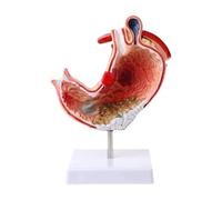 Human Organ Model Abdominal Anatomy Model Anatomy Pathology Stomach Anatomy Model for Medical Education Research Teaching Tool