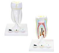 Human organ model,Caries Model - Molar with Tooth Decay Model - for Student Display Human Tooth