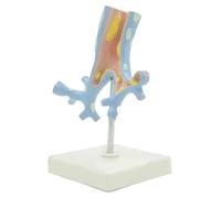 Human Organ Model Human Bronchial Tree Anatomy Model Pathological Bronchial Model Colorful Teaching Model as Visual Teaching Aids for School Study