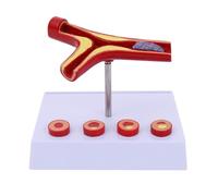 Human Organ Model Human Vascular Model 10X Magnification Vascular Pathology Model Atherosclerosis Anatomy Model for Show and Study for School Study