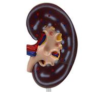 Human organ model,Kidney Model, Human Kidney Model, Frontal Section of Kidney Model for School
