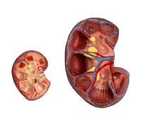 Human organ model, Life-Size Kidney Model, 2 Parts Kidney Model, Natural Large Healthy Kidney Model for Doctors Office,19cm