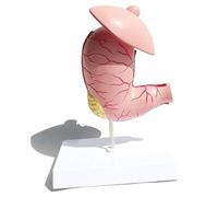 Human Organ Model Pathological Stomach Model Medical Anatomy Teaching Equipment for Digestive Organs (A)