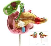 Human Pancreas Spleen Duodenum Gallbladder Pathological Anatomical Model